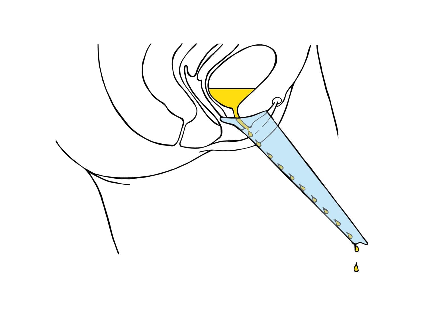 Pibella Urinierhilfe für Frauen Ladyplanet CH